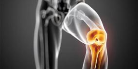 هشاشة عظام الركبة..المراحل والعلاج
