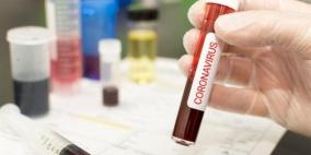 تحذير من اختبارات الأجسام المضادة  لفيروس كورونا