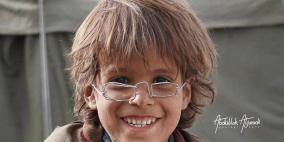 مزاد على "نظارة" طفل نازح يمني يحقق 2.5 مليون ريال