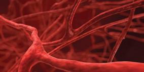 أعراض تشير إلى تمزق الأوعية الدموية 