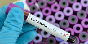 فيروس كورونا: 10 وفيات و395 اصابة جديدة خلال اليوم الأخير