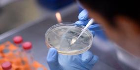 واقعة انتحار تعلق تجارب لقاح  كورونا الصيني في البرازيل