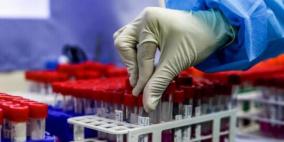 الصحة العالمية تسلم 19500 مادة فحص كورونا إلى غزة