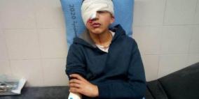 فيديو.. إصابة طفل برصاص مطاطي في عينه بالخليل