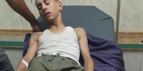 تفاصيل تعذيب مستوطنين لطفل بعد دهسه واختطافه جنوب جنين 