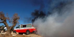 إصابات بمواجهات مع الاحتلال في بيتا وبيت دجن