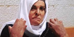 محكمة الاحتلال تمنع الأسيرة إسراء جعابيص من إجراء عملية في الأنف