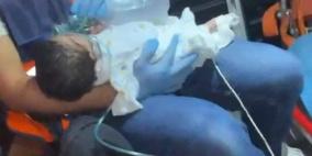 إصابة ثلاثة أطفال اختناقا بغاز الاحتلال في القدس