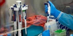 الكويت تعلن تسجيل أول إصابة بالكوليرا