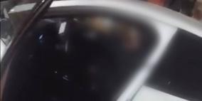 صورة: شخصية "معروفة" بين المستوطنين ضمن مصابي عملية الخليل