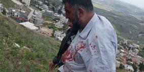إصابتان جراء اعتداء المستوطنين على مواطنين ببلدة برقة في نابلس
