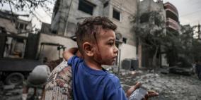 حصيلة: 704 شهداء ونحو 3900 مصاب في غزة والضفة
