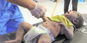 17 شهيدا في قصف منول بخانيونس و سلسلة غازات و قصف مدفعي على غزة و رفح