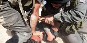 جيش الاحتلال يعتدي بالضرب على شابين في دورا جنوب الخليل