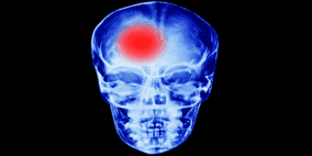 عامل محيط بنا قد ينقذنا من خطر الإصابة بالسكتة الدماغية أو الخرف