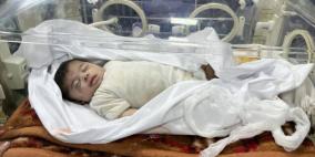 ارتفاع عدد الأطفال ضحايا الجوع بمستشفى كمال عدوان إلى 15