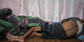 الموت جوعًا حتمية في قطاع غزة وعواقب طويلة الأمد تهدد الأجيال