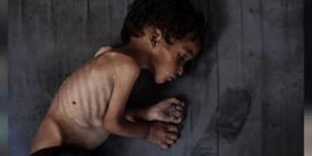 خاص| الجوع كسلاح إبادة.. كيف تخطط إسرائيل لتجويع غزة ودفع سكانها للهجرة؟
