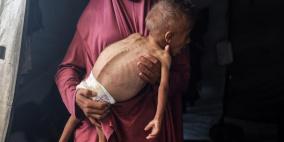 قطاع غزة على "أعتاب مقتلة جماعية مرتقبة بحق 100 ألف طفل خلال أيام"