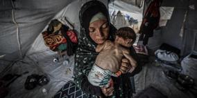 8 وفيات نتيجة المجاعة وسوء التغذية خلال الـ24 ساعة الماضية