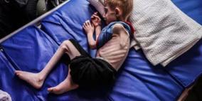 7 وفيات نتيجة التجويع في غزة خلال الساعات الماضية