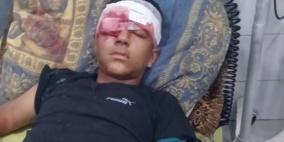 إصابة طفل بجروح خطيرة خلال اقتحام الاحتلال بيت عوا جنوب غرب الخليل