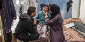 "الإحصاء": تضاعف الإصابات الجسيمة في غزة إلى 42 ألفاً وارتفاع حاد في حالات البتر