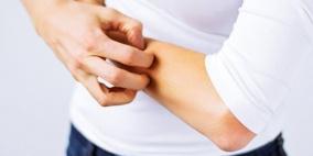 الفيتامينات التي تقلل الحكة