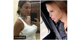 عملية تجميل جديدة تجعل رولا سعد نسخة من نيكول سابا