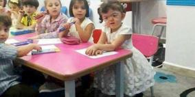 طفلة سوريّة رفضتها الروضة بسبب شكلها!