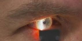 فيديو:إذا كنت ترغب في رؤية جمال الحياة بوضوح أكبر فعليك "بحلاقة العين" من الداخل!