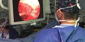 مستشفى المقاصد: إجراء عمليتين لاستئصال أورام الصدر بتقنية حديثة لأول مرة في فلسطين والمنطقة