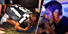 فيديو: بلاغ كاذب كاد ان يتسبب بكارثة بين جماهير يوفنتوس 