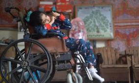 منظمة أمريكية تُحذّر: 6 آلاف مبتور في غزة يحتاجون إعادة تأهيل عاجل ودعم نفسي 