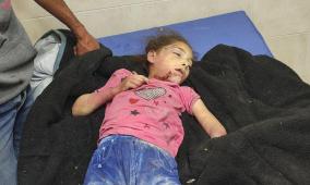 اليونيسيف: أطفال غزة يواجهون خطر الجوع والمرض والموت