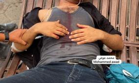 11 شهيدا بقصف الاحتلال مناطق متفرقة من مدينة غزة