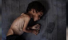 خاص| الجوع كسلاح إبادة.. كيف تخطط إسرائيل لتجويع غزة ودفع سكانها للهجرة؟