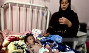 ليرتفع العدد إلى 3 منذ أمس: وفاة رضيع نتيجة سوء التغذية والمجاعة في قطاع غزة