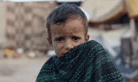 طبيب يكشف لراية عن مرض خطير يهدد حياة الأطفال في غزة