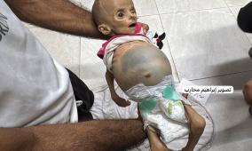4 وفيات جراء التجويع في غزة خلال الـ24 ساعة الماضية