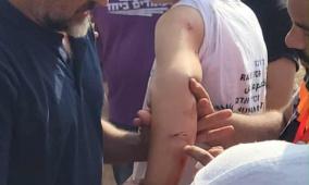 مستوطنون يعتدون على متضامنين قرب دير استيا