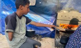 أحمد… طفلٌ خرج من بين الرماد يحمل نصف جسدٍ وقلبًا كاملًا