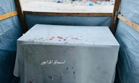 استشهاد مواطن برصاص الاحتلال شرق مدينة غزة