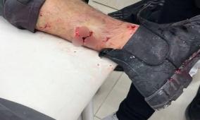 إصابتان برصاص الاحتلال في بلدة الرام