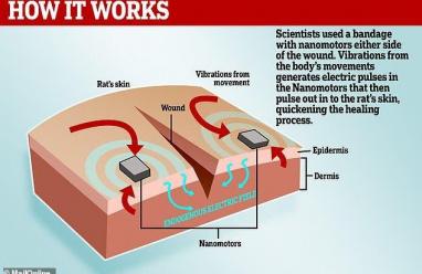 ضمادة إلكترونية.. أمل لجروح لا تلتئم