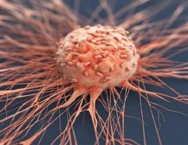 السرطان في 2024.. هذه الأورام الأكثر شيوعا وفتكا