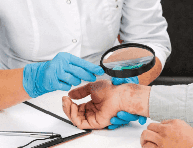 خاص | الصيف يرفع حدة الأمراض الجلدية وتحذيرات من إهمال الوقاية