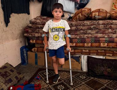 قصة مصورة| أحمد.. إصابةٌ كان يمكن علاجها فانتهت ببتر ساقه