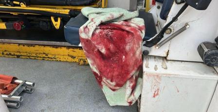 إصابة طفلين برصاص الاحتلال شرق مخيم المغازي وسط غزة