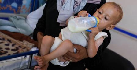 طبيب في مجمع ناصر لراية: سوء التغذية يهدد جيلا كاملا في غزة
